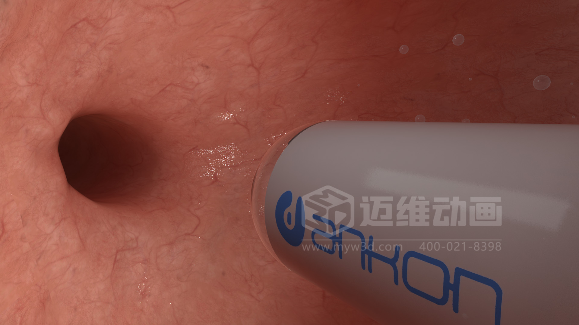 磁控膠囊機(jī)器人三維動(dòng)畫(huà)(圖4)